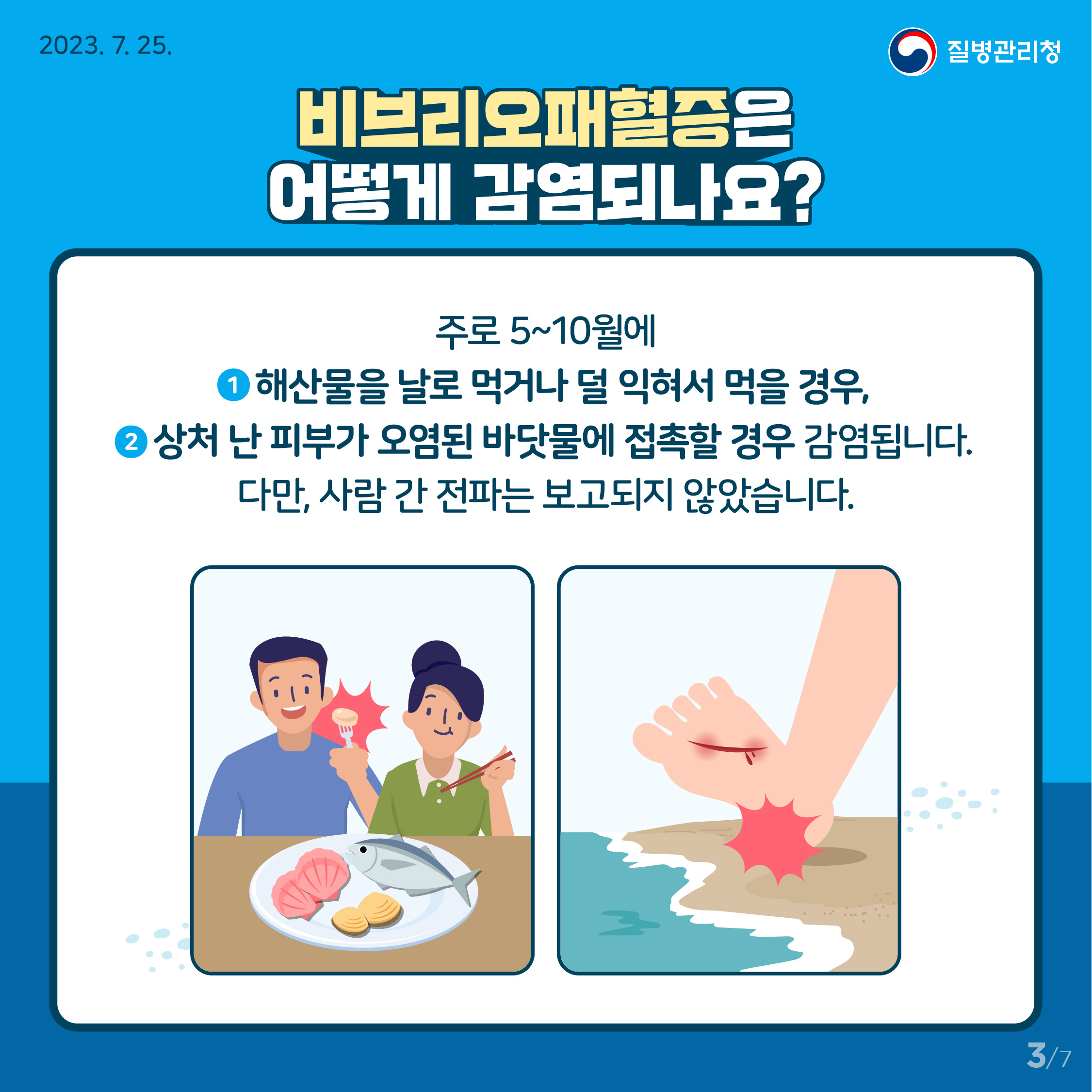 비브리오 패혈증 감염경로