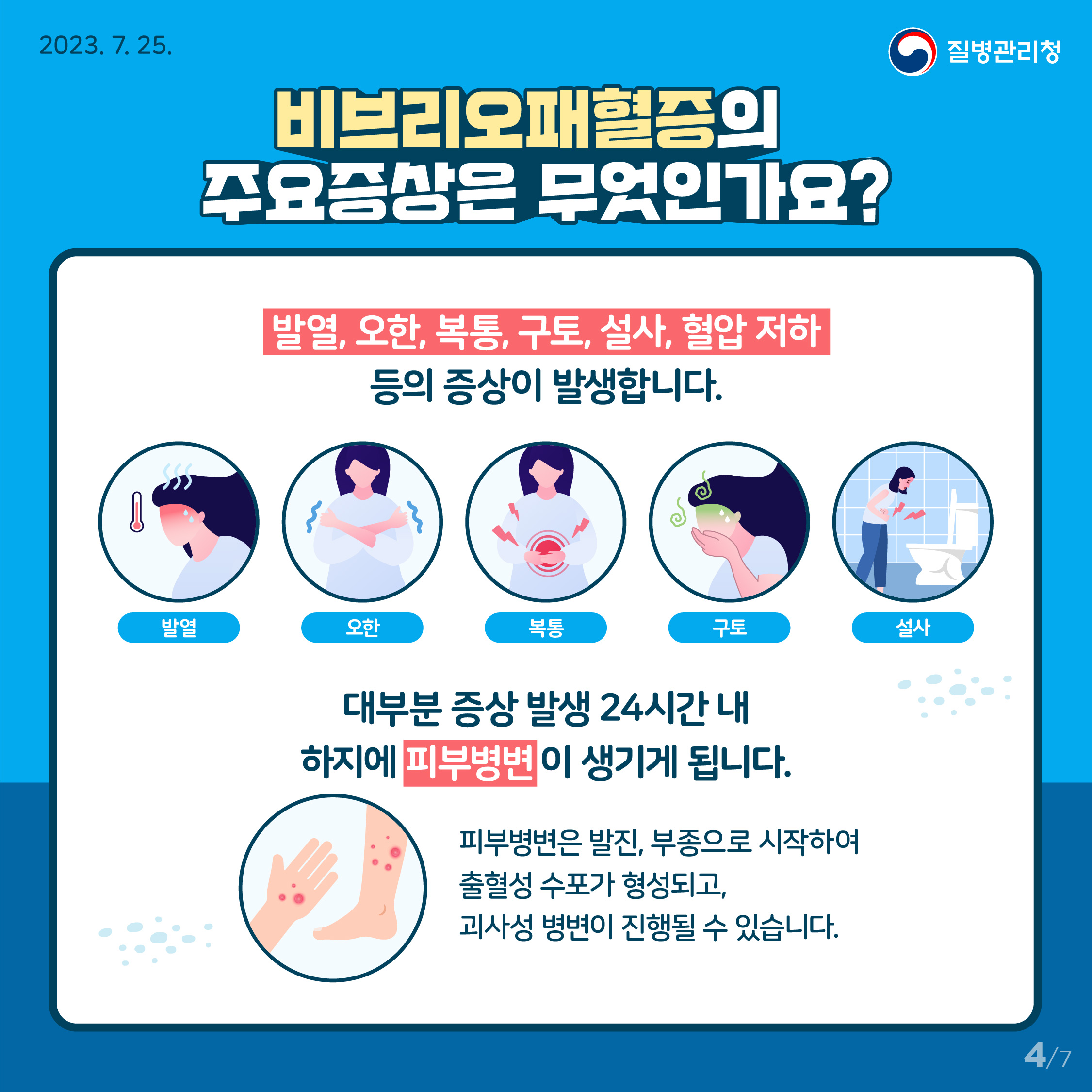 비브리오 패혈증 증상설명