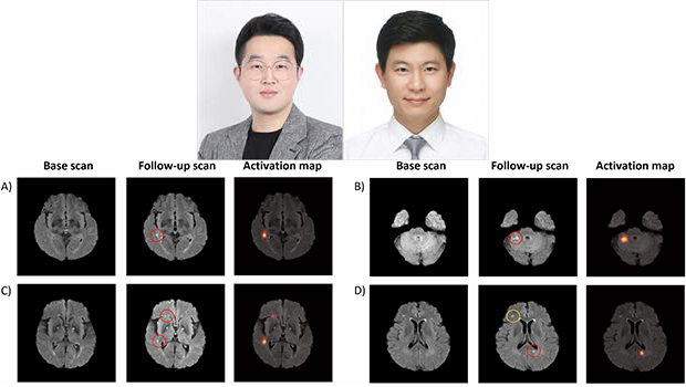 인천대 조환호 교수 연구팀, 한양대 구리병원 박성호 교수팀과 협력&hellip; &lsquo;무증상 뇌경색&rsquo; 자동 탐지 AI 모델 개발
